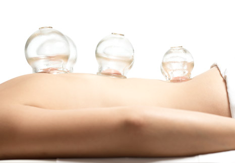 Cupping